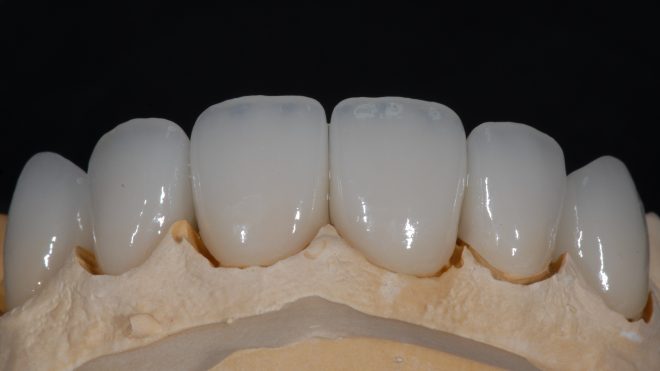 Протезирование зубов и челюстей